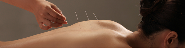 acupuncture in barnet