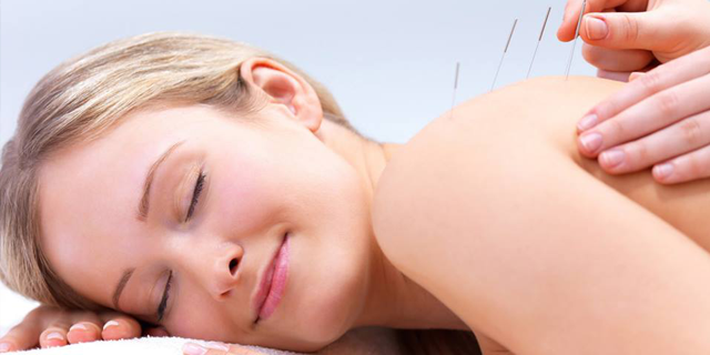 acupuncture in barnet